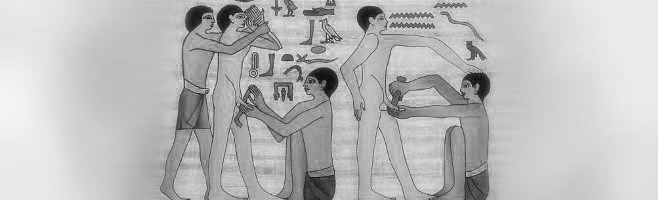 circumcision-egypt